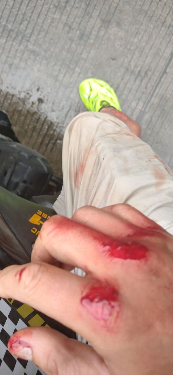 龟速摔车等于悲剧